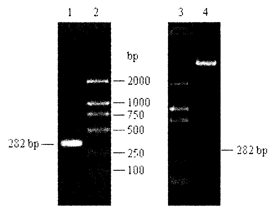 Time-resolved fluorescence (TRF) immunized detection kit of ovarian cancer tumor marker HE4