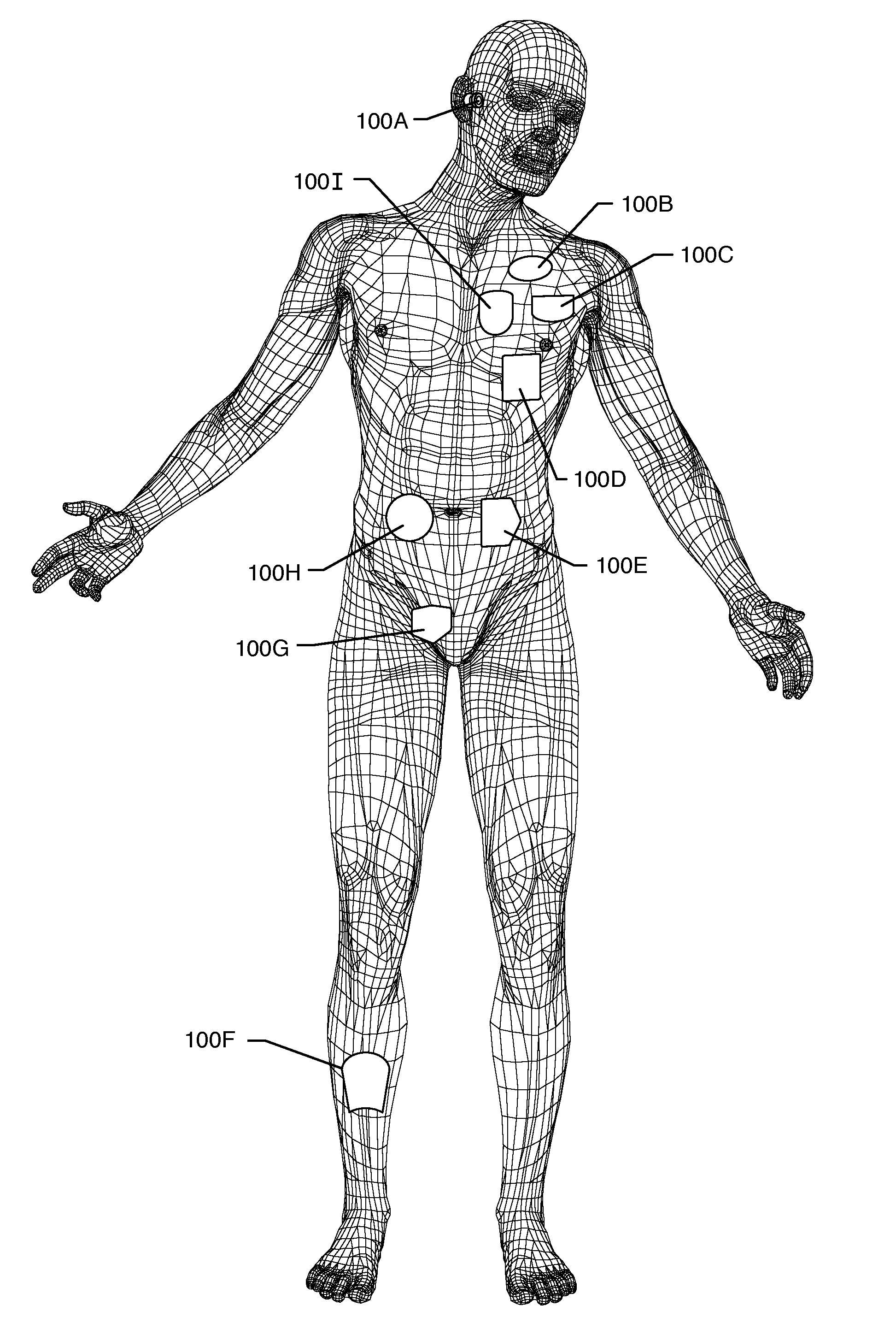 Rfid-enabled aimd programmer system for identifying MRI compatibility of implanted leads