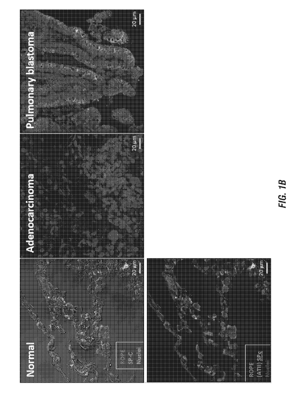 Compositions comprising antisense-encoded erythropoietin receptor and use thereof