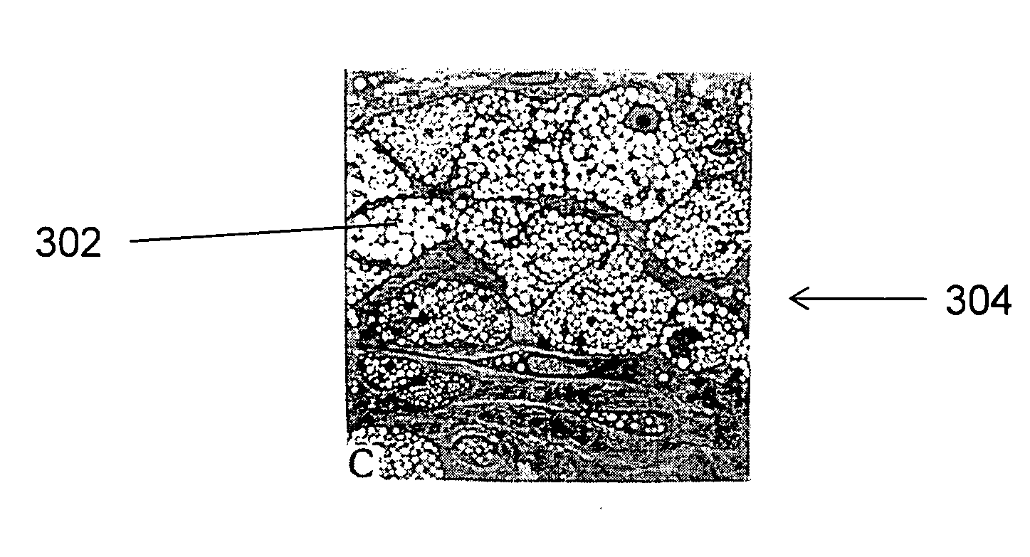 Large Animal Model for Human-Like Advanced Atherosclerotic Plaque