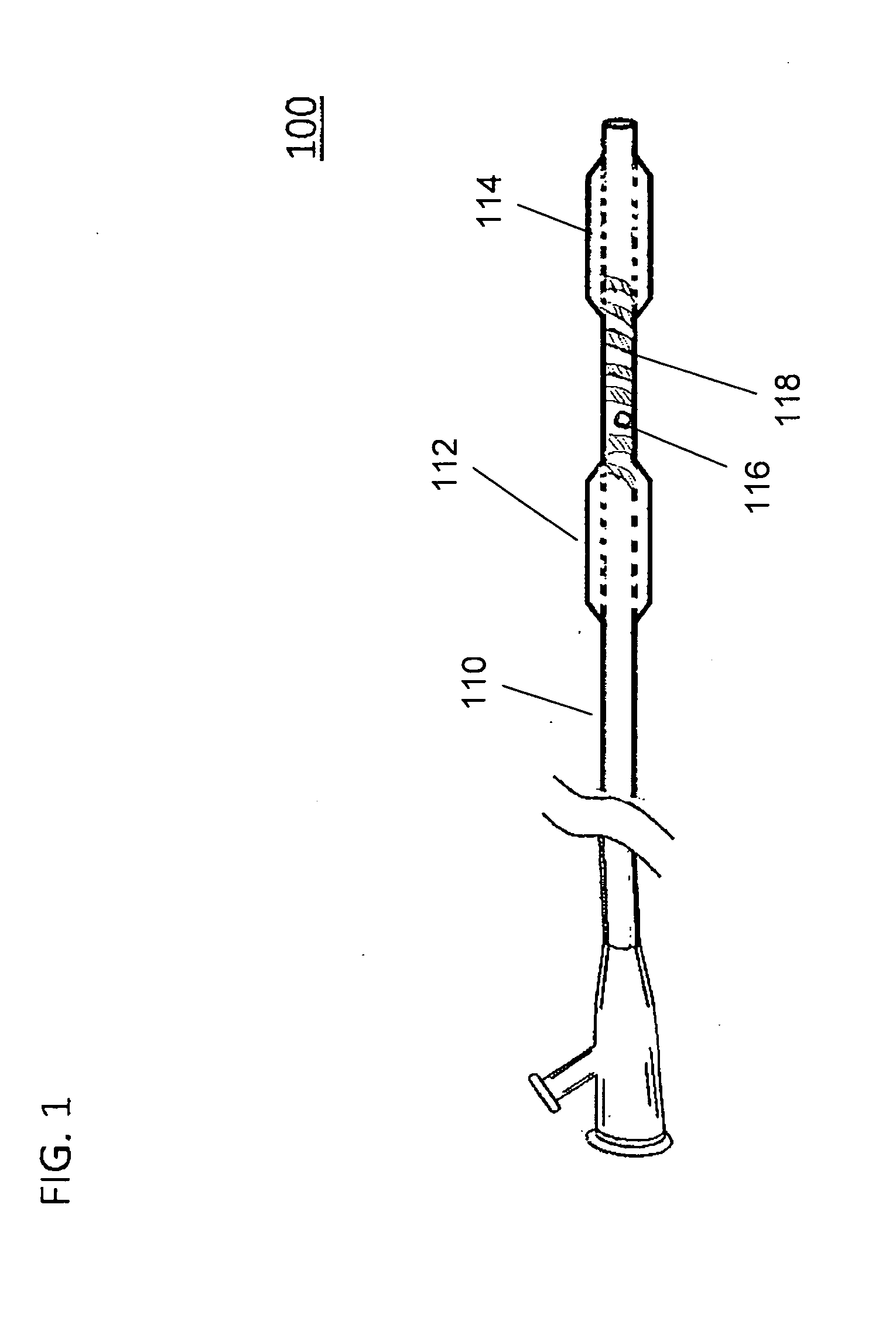 Large Animal Model for Human-Like Advanced Atherosclerotic Plaque