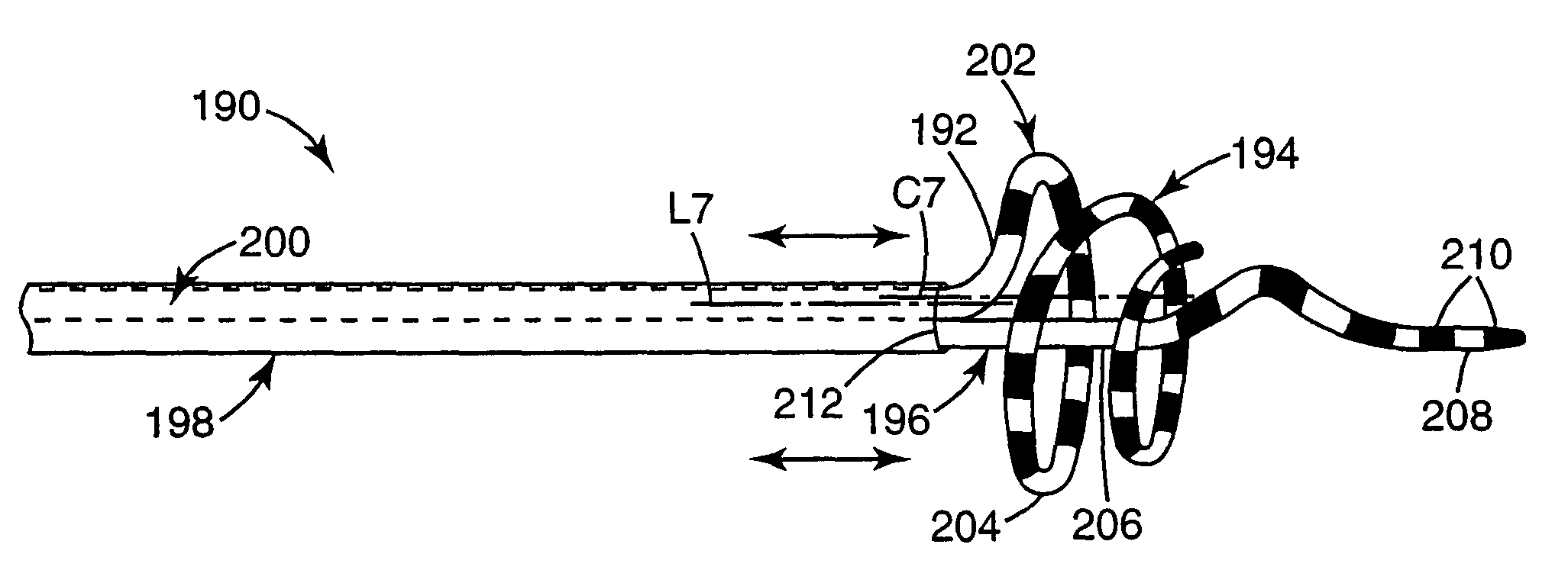 Ablation catheter assembly with radially decreasing helix and method of use