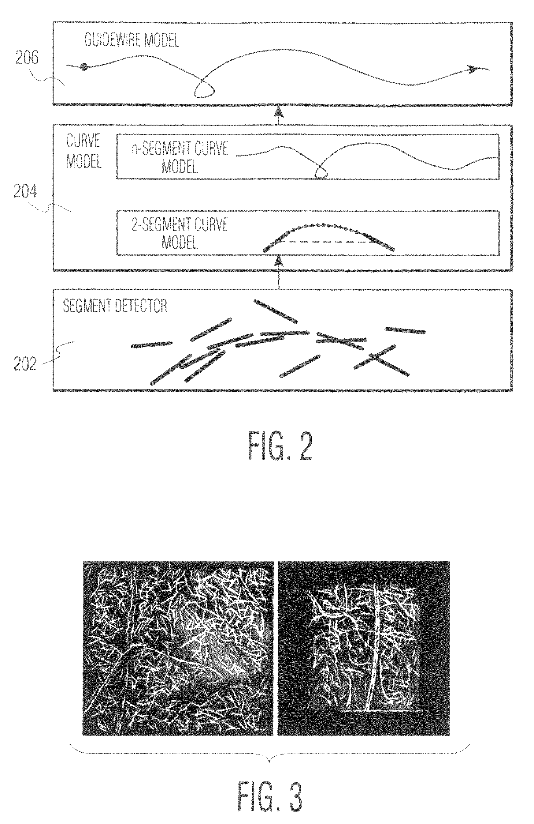 System and method for detecting and tracking a guidewire in a fluoroscopic image sequence