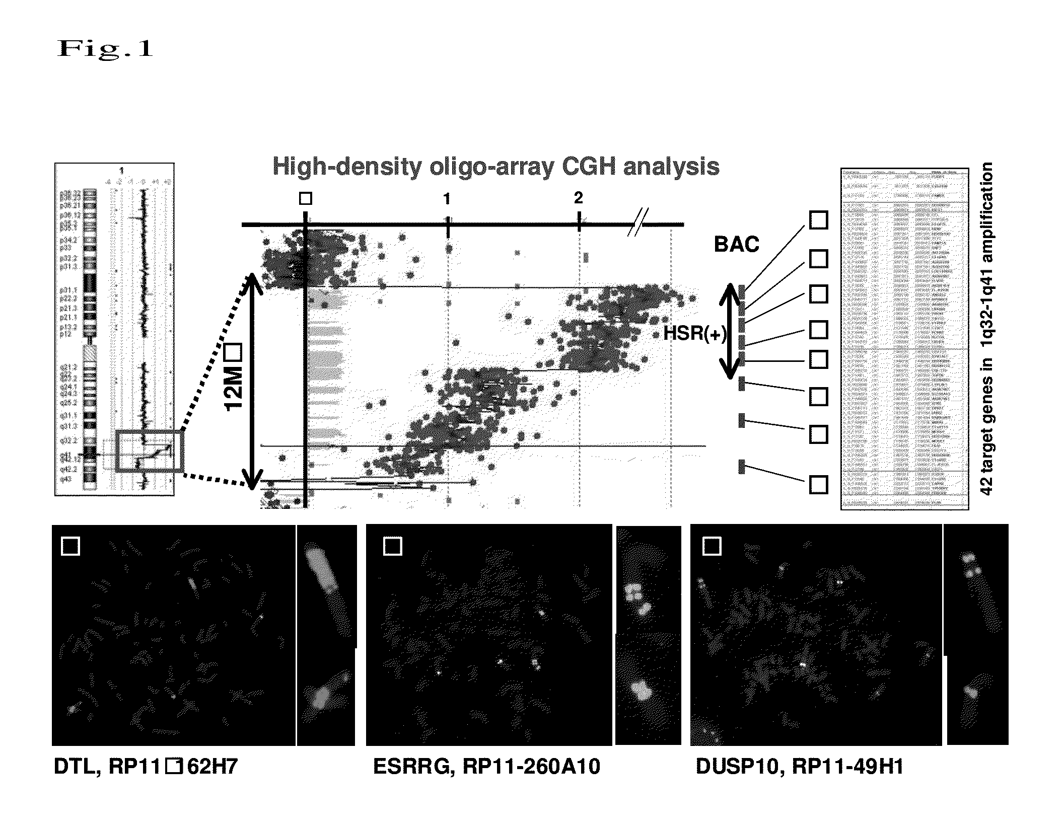 Method for detecting esophageal carcinoma and agent for suppressing esophageal carcinoma