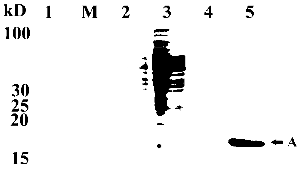 Immobilization method of Thermus lipase