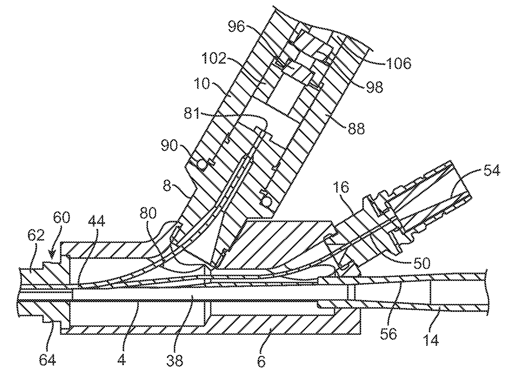 Endoscope system for treatment of sinusitis