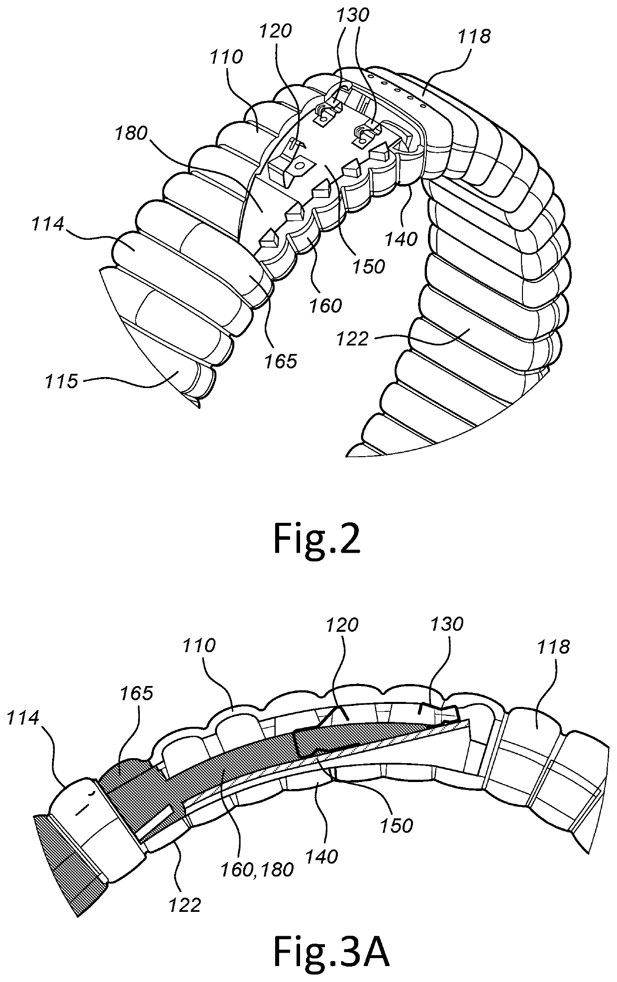 Smart wearable device