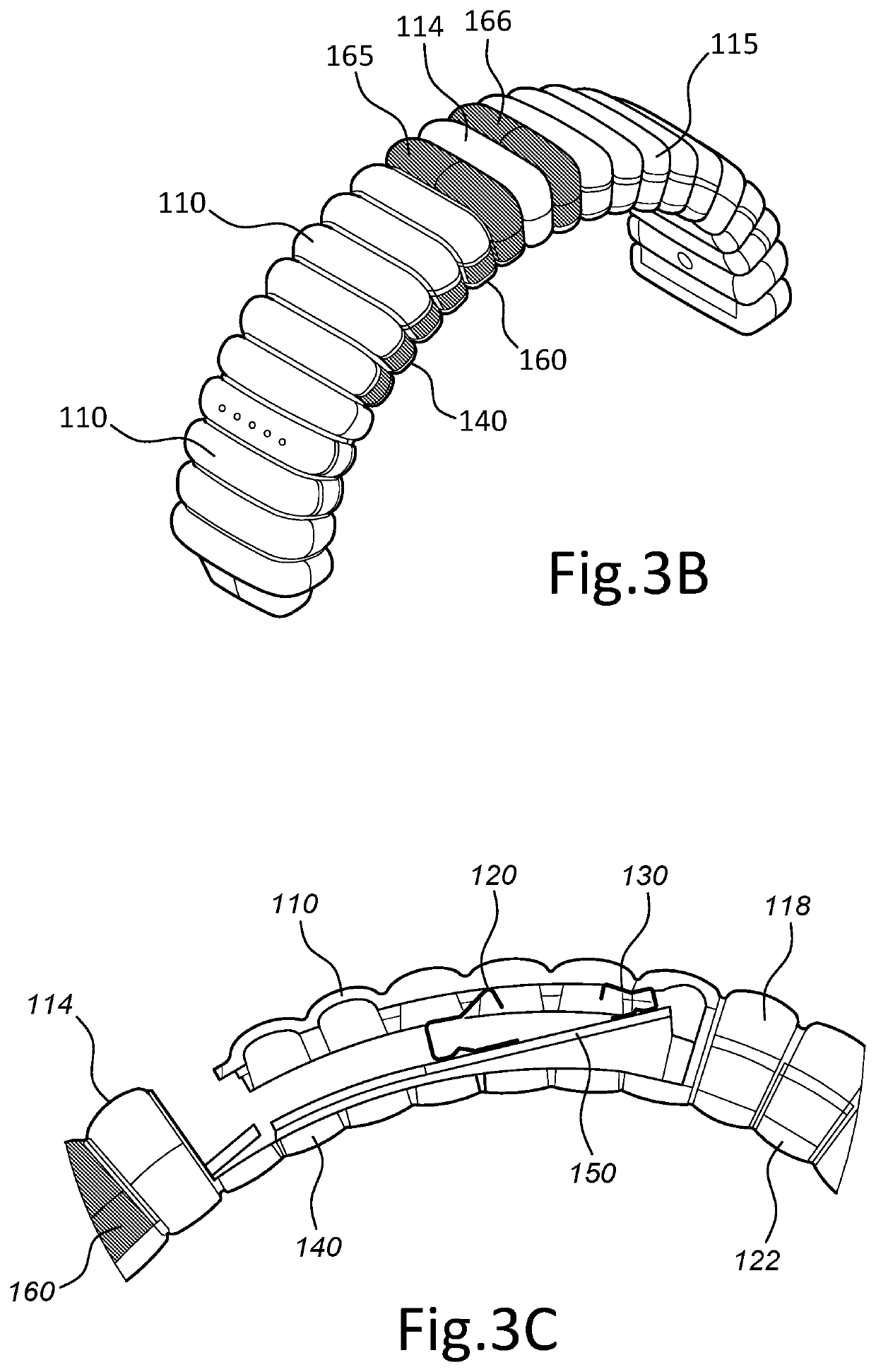 Smart wearable device