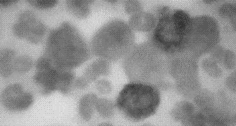 Equipment, system and method for separating CTCs (circulating tumor cells)