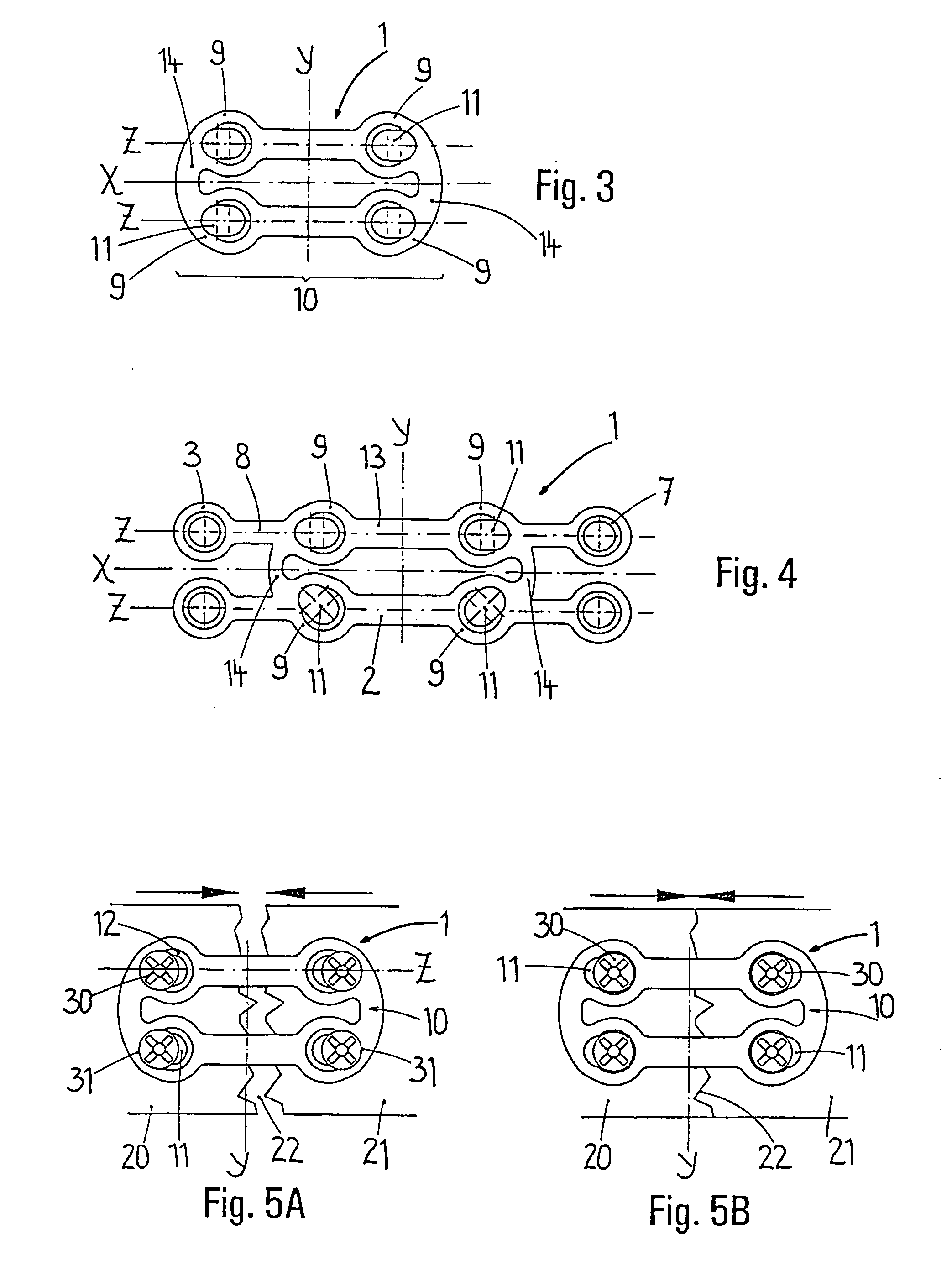 Osteosynthetic bone plate