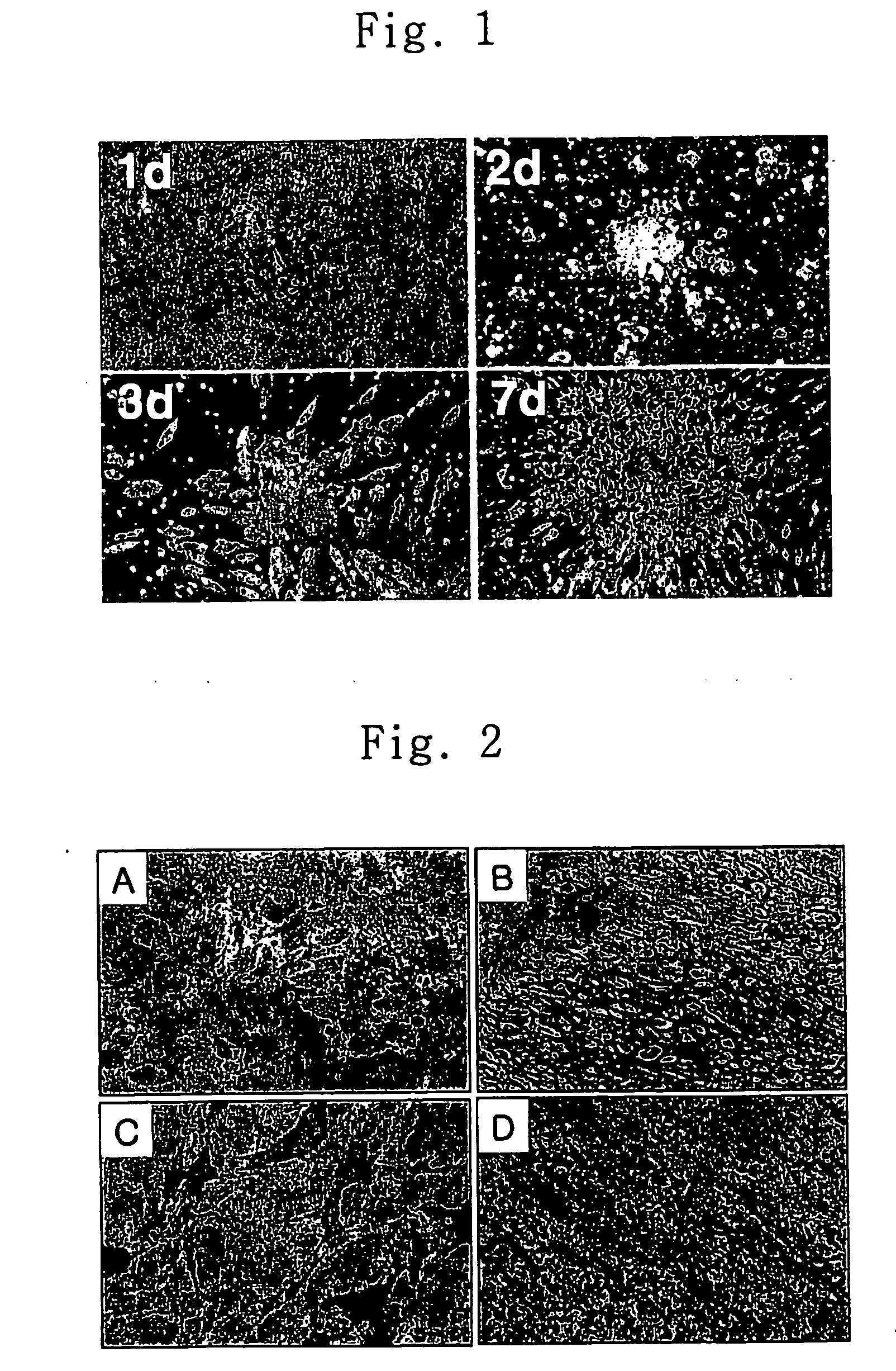 Method for transdifferentiating mesenchymal stem cells into neuronal cells