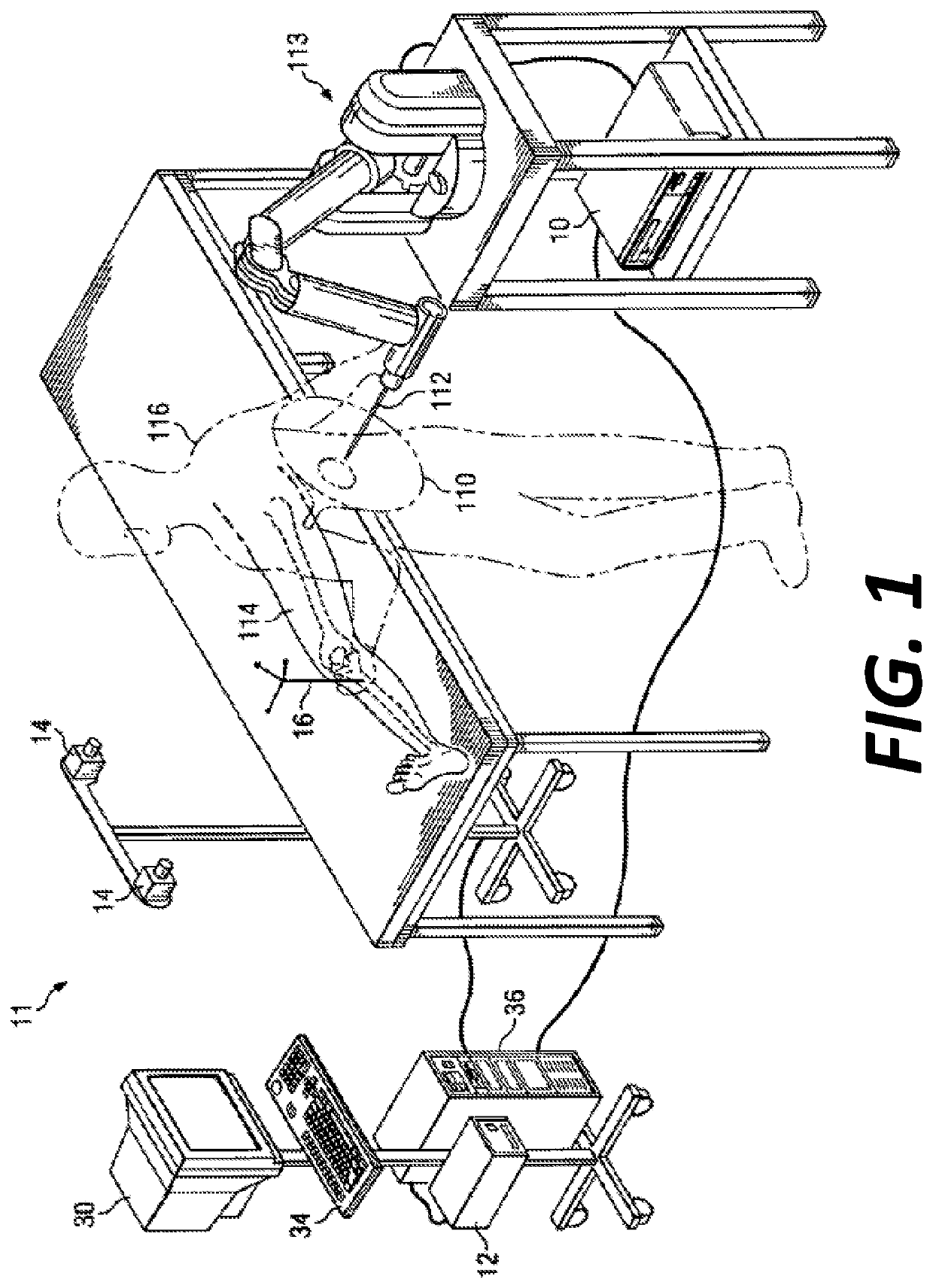 CT Based Probabilistic Cancerous Bone Region Detection