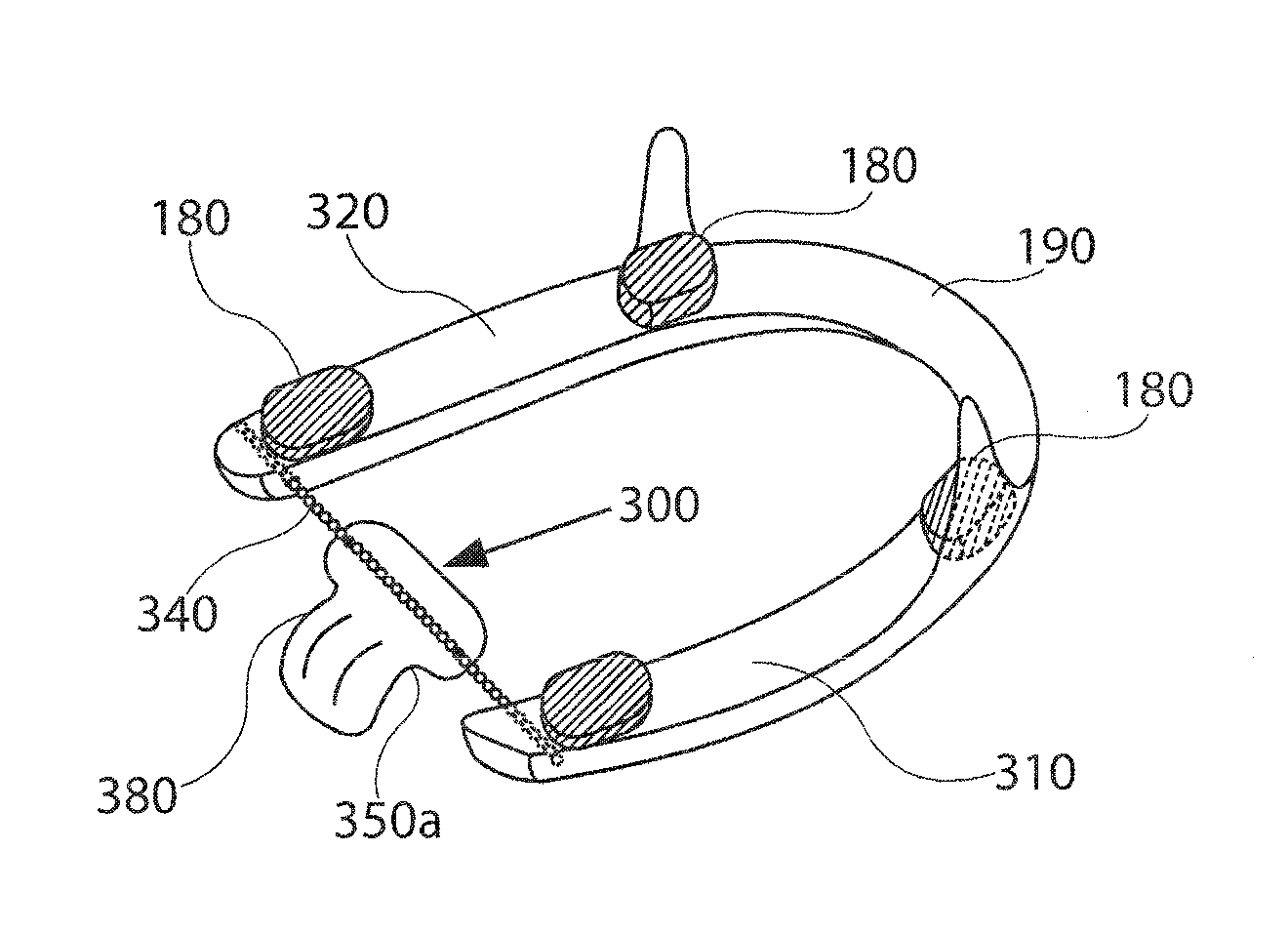 Mandibular advancement device