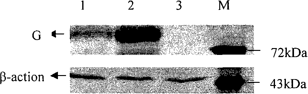 Construction of recombinant rabies virus of double-expression G gene and biological property analysis thereof