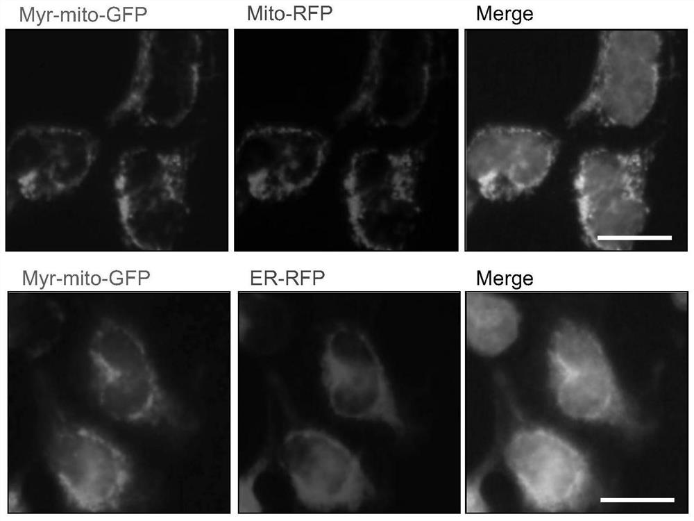 Myristoylated polypeptide for coding mitochondrial localization as well as preparation method and application of myristoylated polypeptide