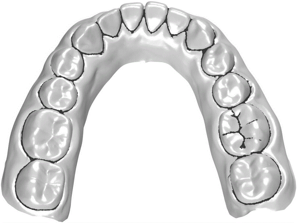 Triangular grid tooth segmentation method based on path planning