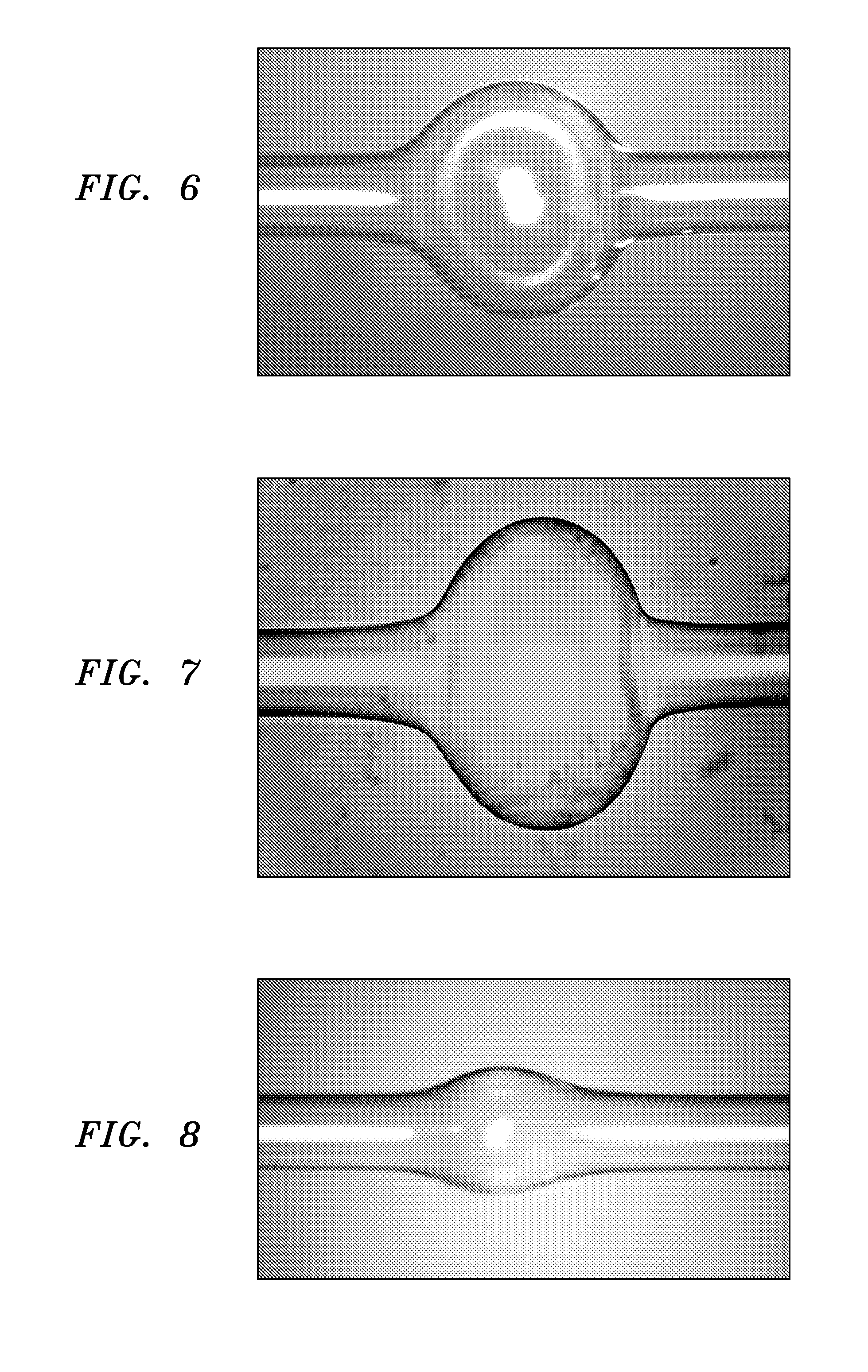 Microbubble optical resonator