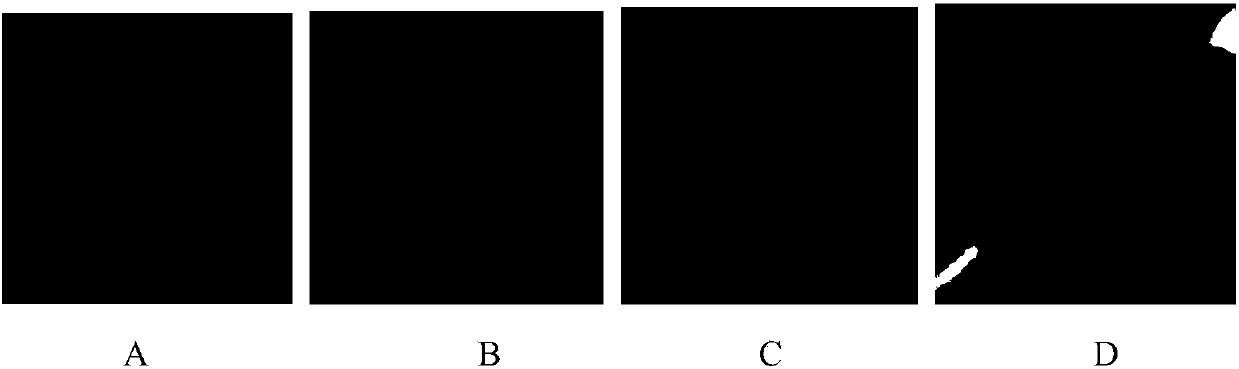 Method for automatically extracting tracheal tree from chest CT image