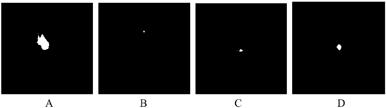 Method for automatically extracting tracheal tree from chest CT image