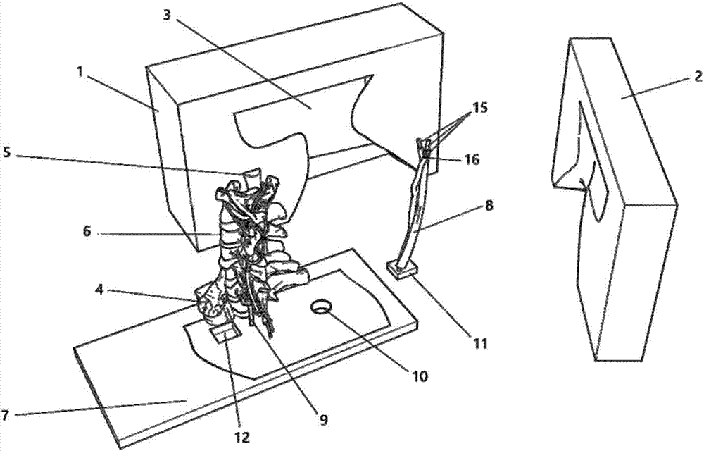 Method for manufacturing operation simulation model and cervical plexus block anaesthesia model