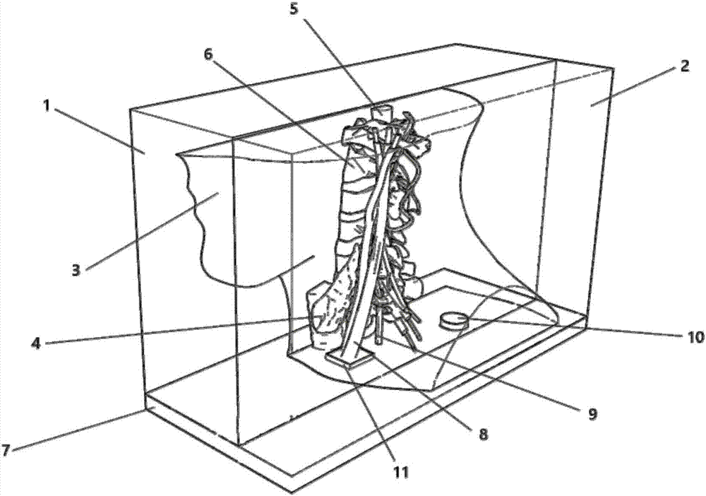 Method for manufacturing operation simulation model and cervical plexus block anaesthesia model