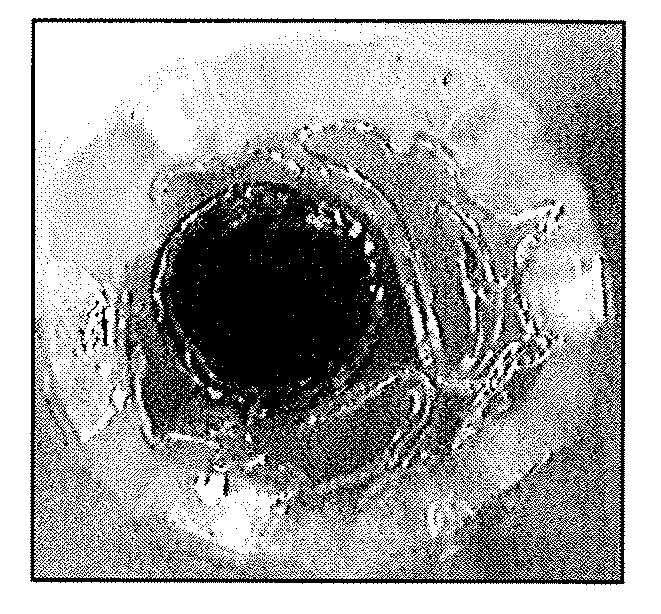 Uniform Crimping and Deployment Methods for Polymer Scaffold