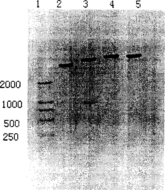 Recombinant bacillus Calmette-Guerin vaccine and its preparation method