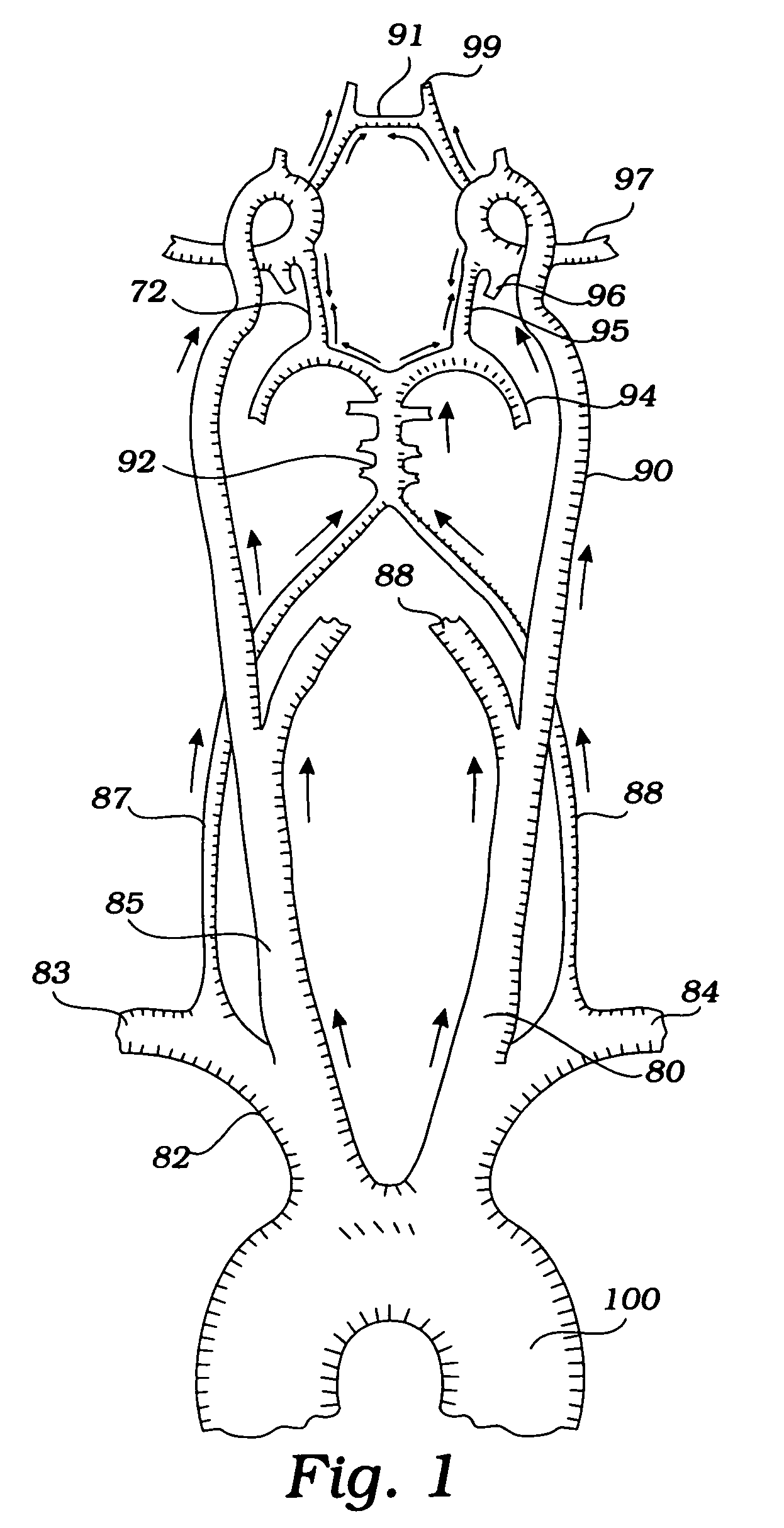 Devices and methods for preventing distal embolization using flow reversal and perfusion augmentation within the cerebral vasculature