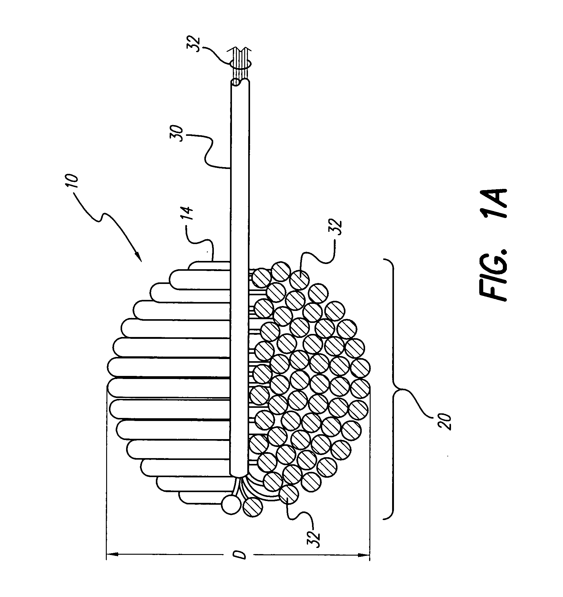 Soft, middle-ear electrode for suppressing tinnitis