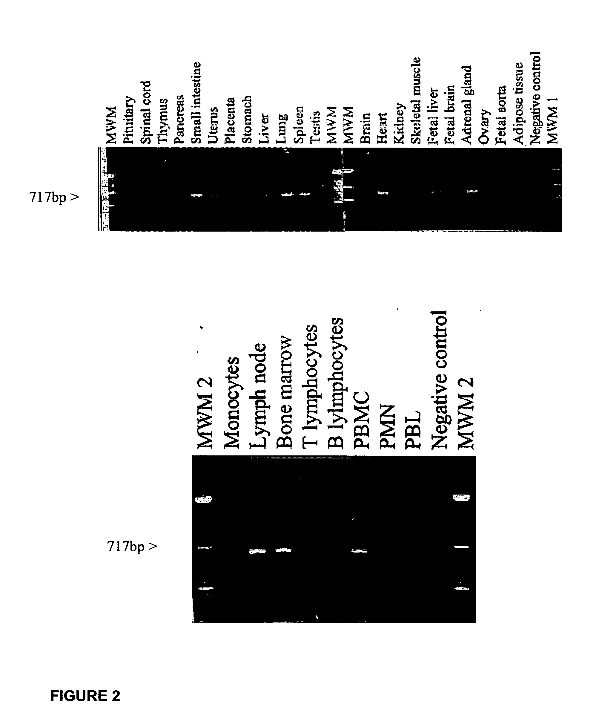 Ligand for G-protein coupled receptor FPRL2 and uses thereof