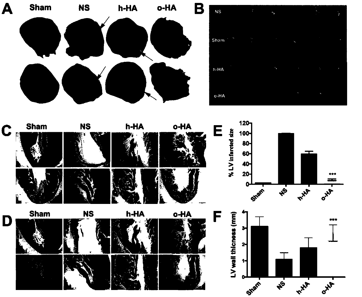 Use of HA-Oligo or salt of HA-Oligo in preparation of medicines for treating miocardial infarction