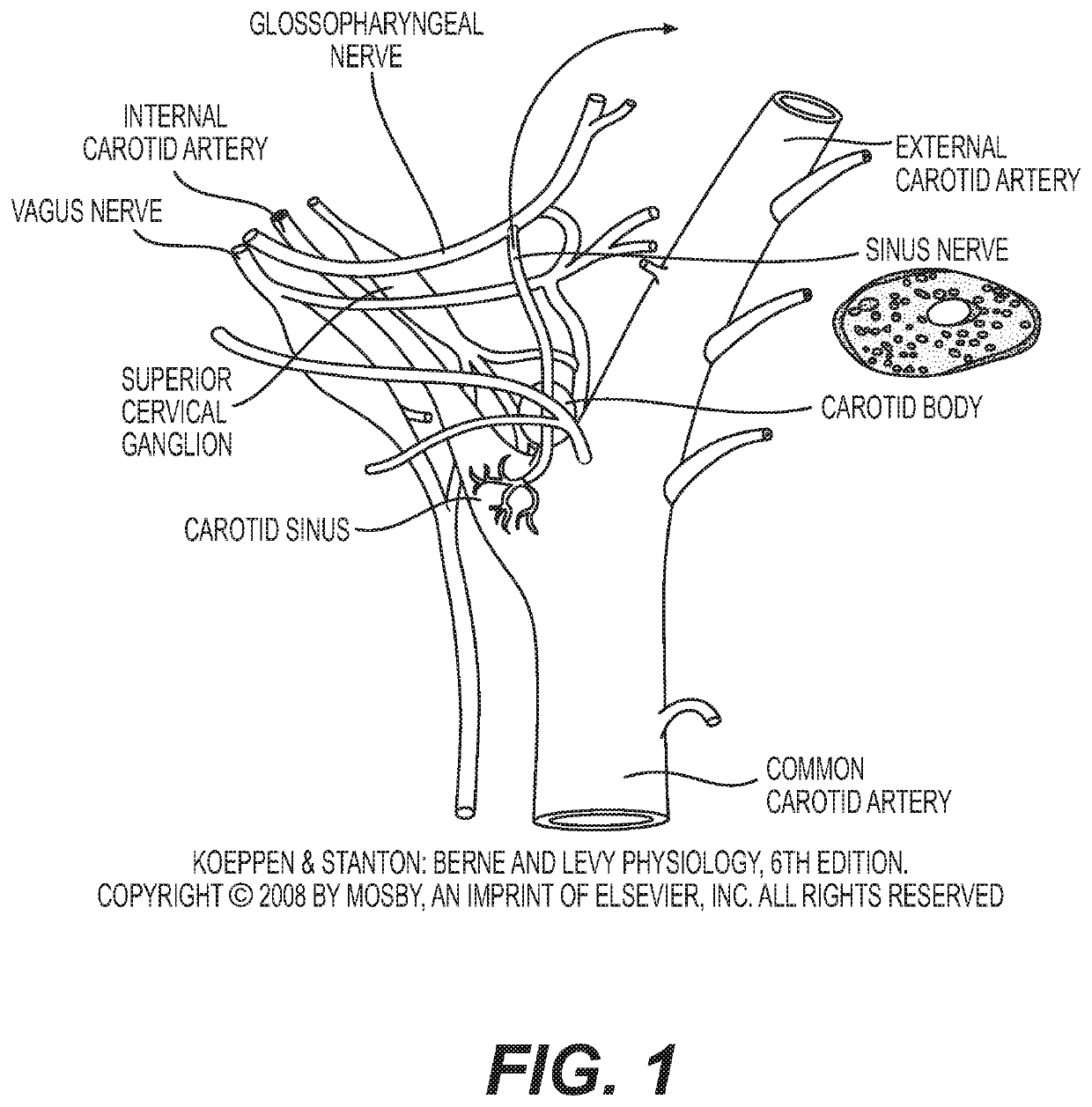 Neuromodulation device