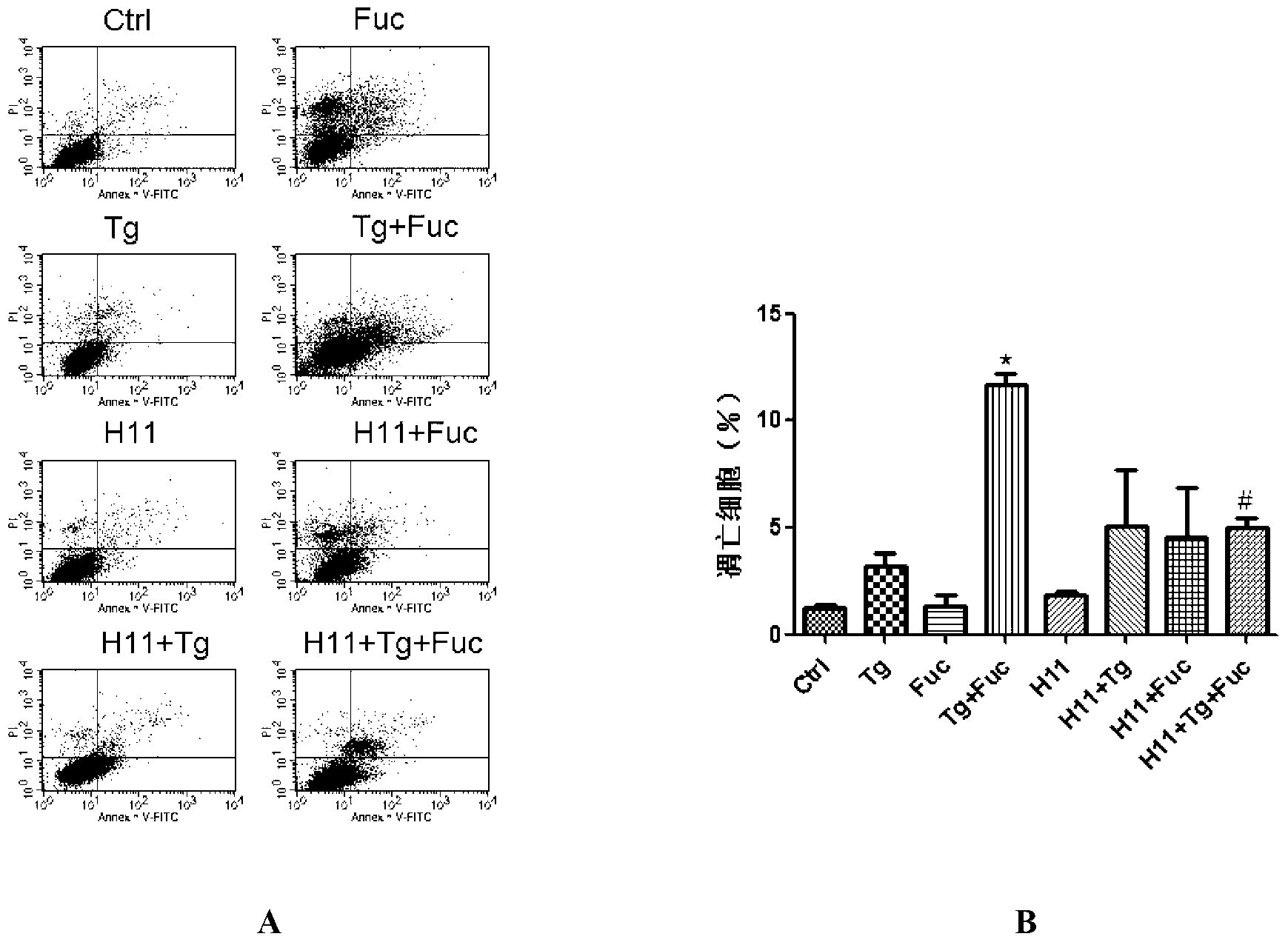 Polypeptide having protection effect on cerebral ischemic injuries, and its application