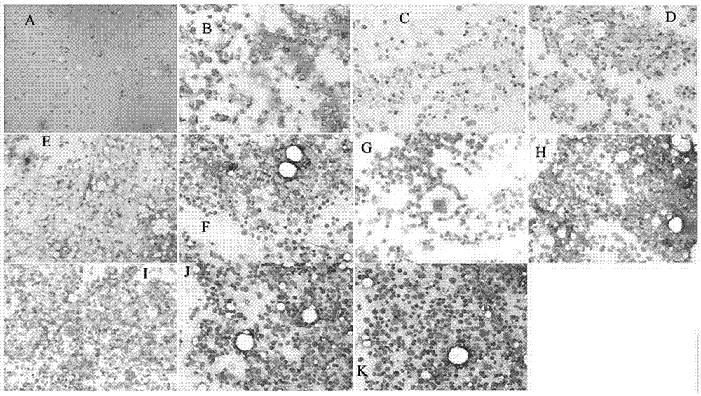 Pharmaceutical composition and application thereof in preparation of drug for treating bone marrow hematopoietic function disorder