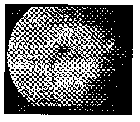 Automatic eye fundus image vessel detecting method based on PCNN (pulse coupled neural network)