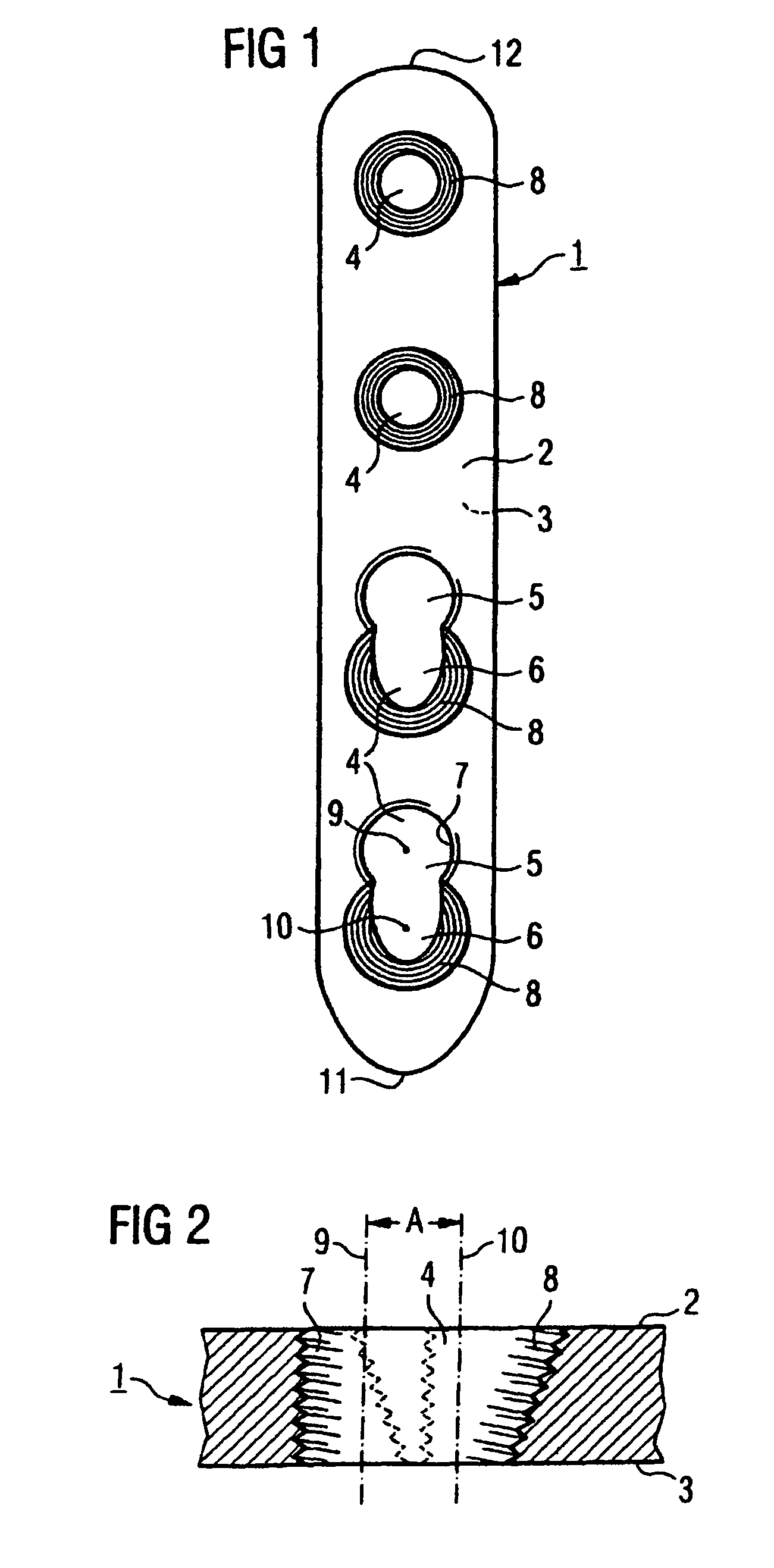 Bone plate