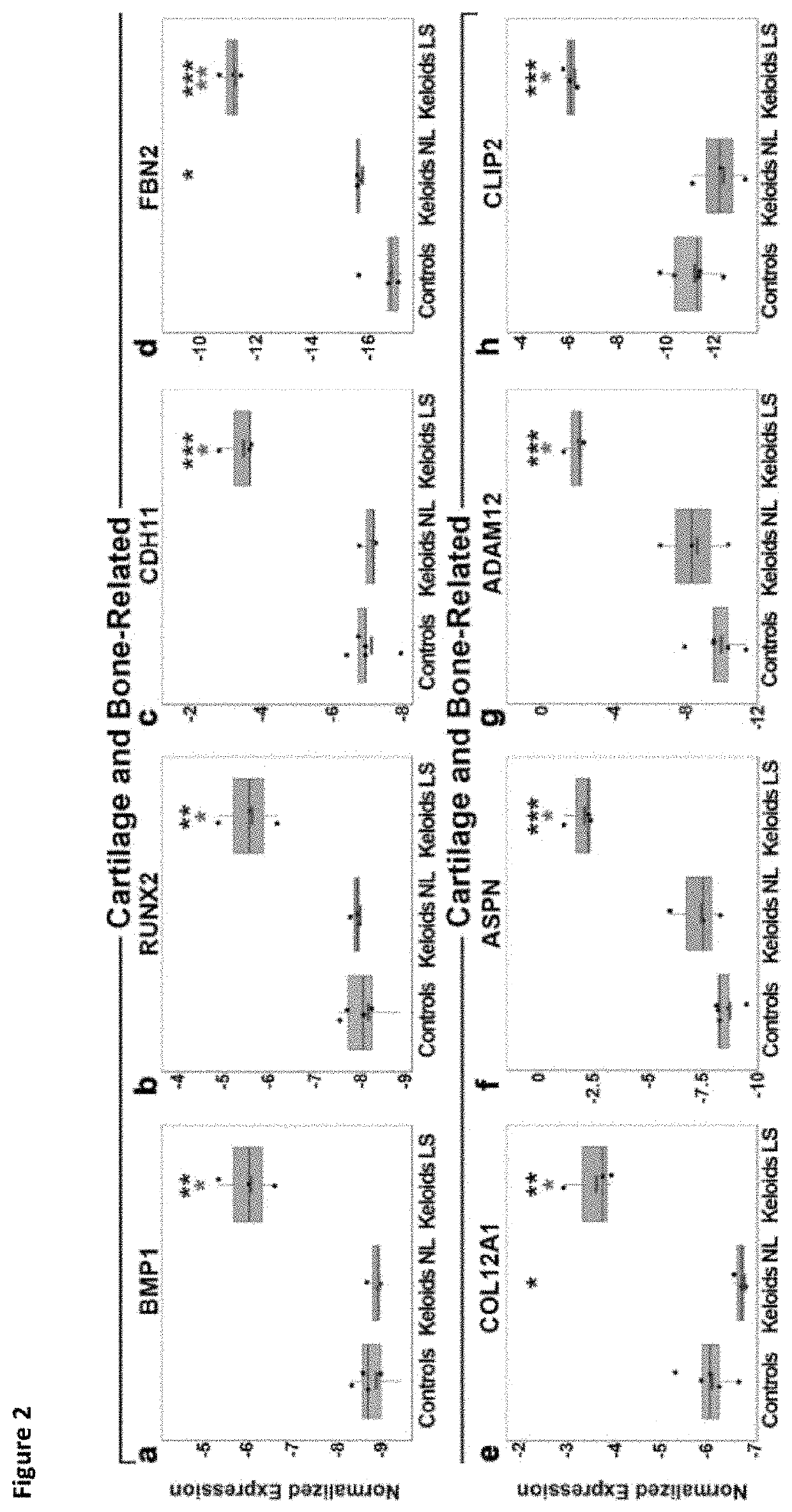 Method of treating keloids