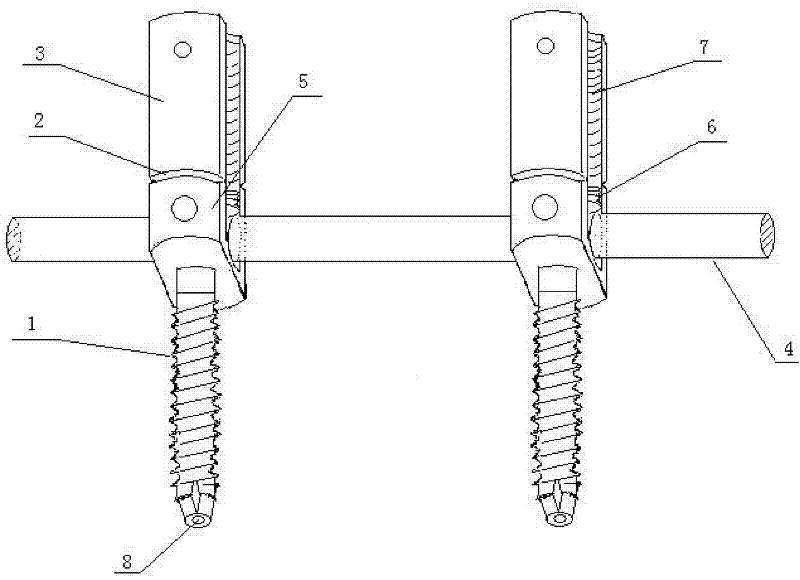 Pedicle screw