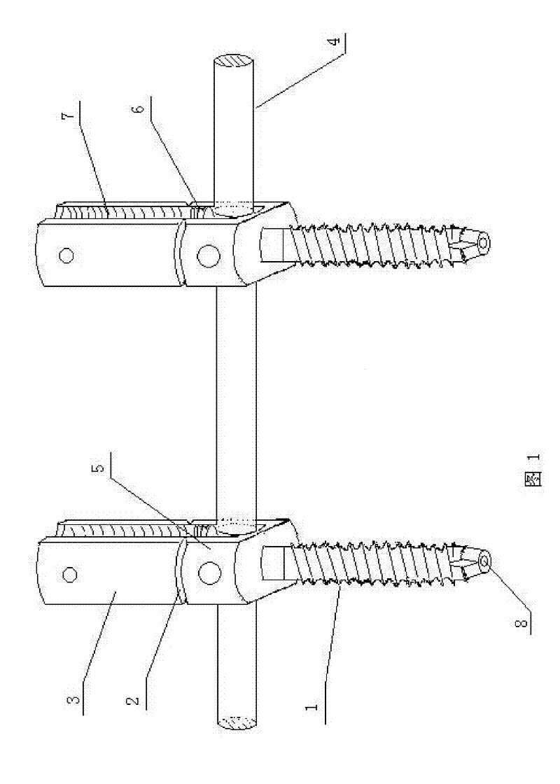 Pedicle screw