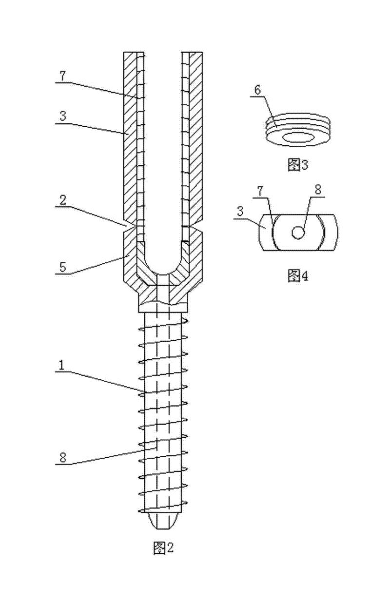 Pedicle screw