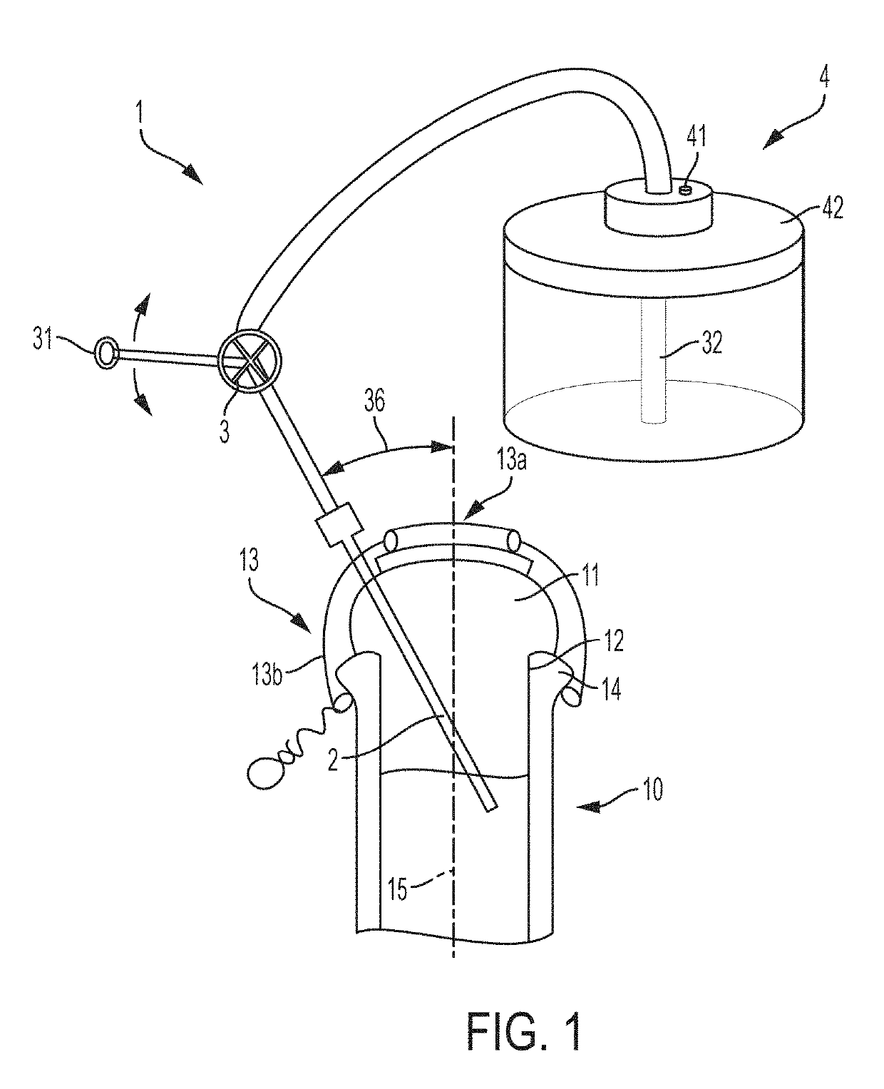 Beverage extractor for sparkling beverages