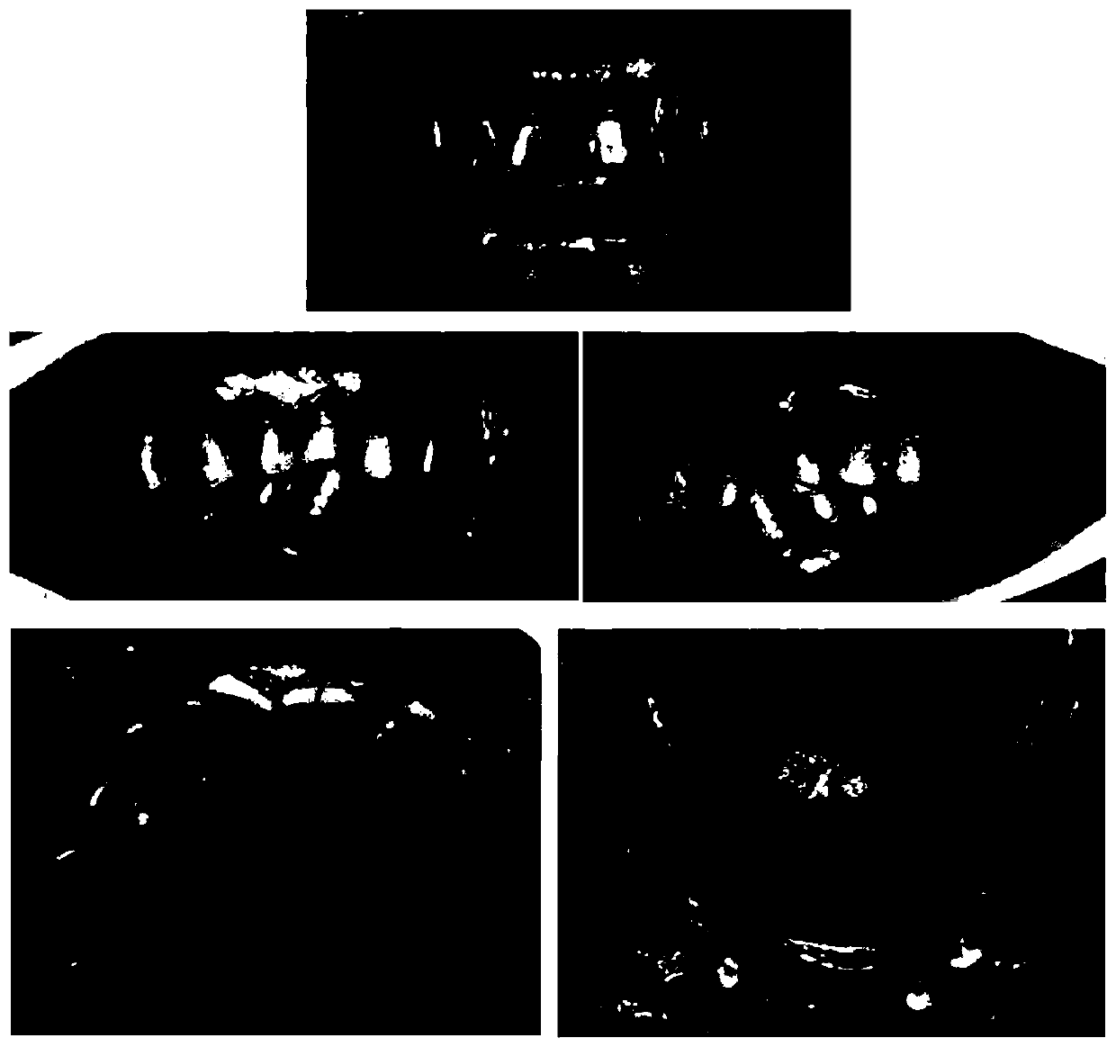 Tooth guard plate in periodontal postoperative operation area and manufacturing method thereof