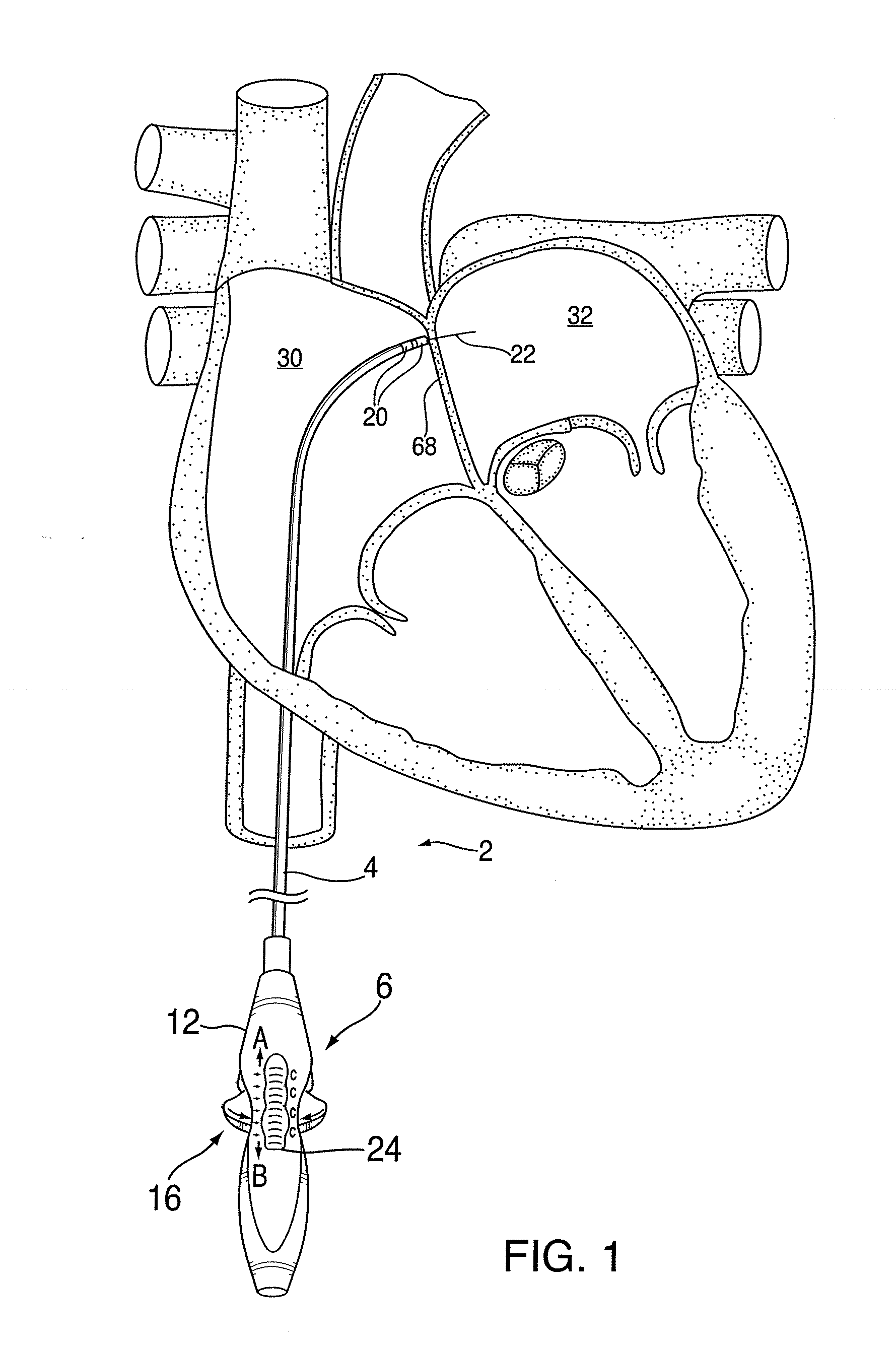 Apparatus for safe performance of transseptal technique and placement and positioning of an ablation catheter