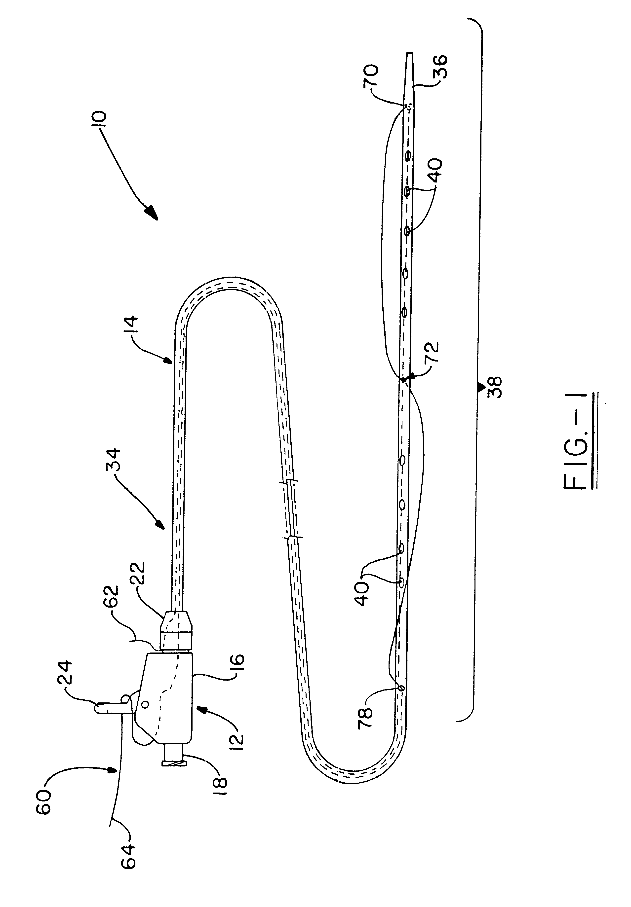 Double-loop catheter