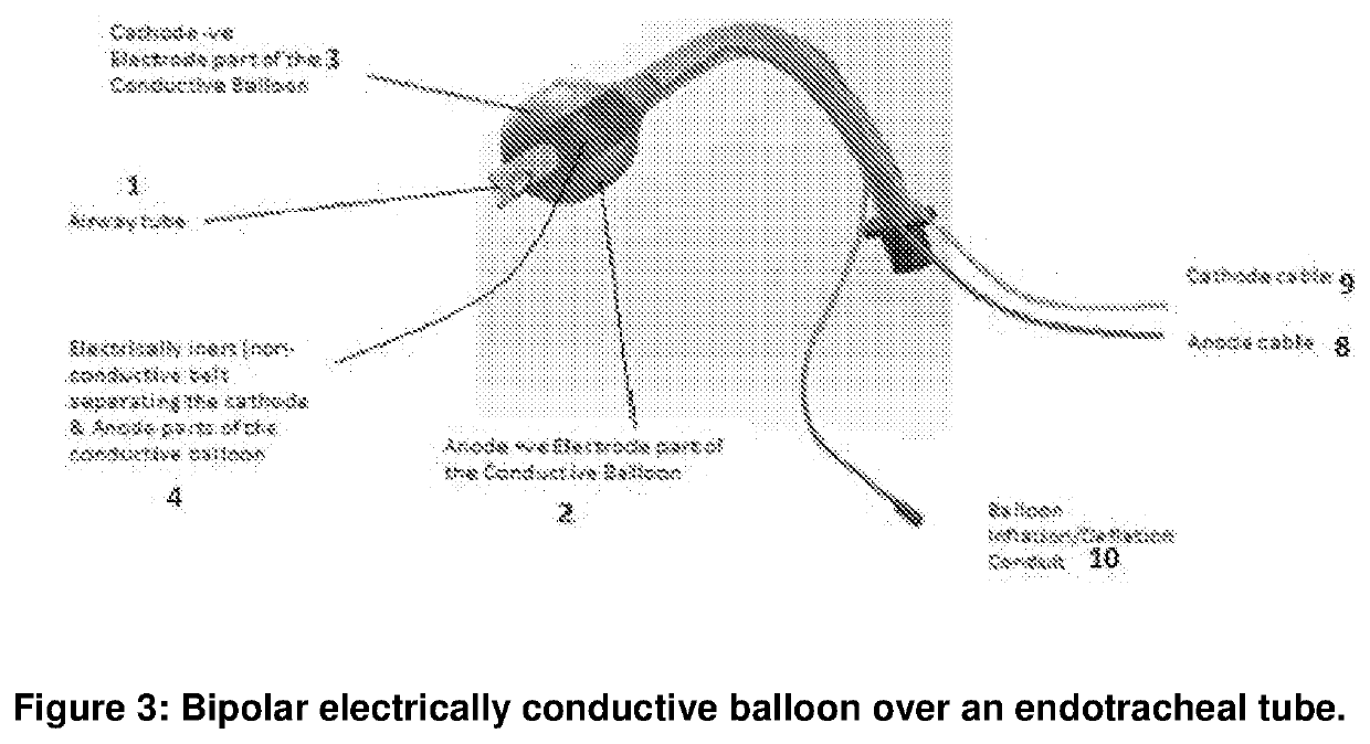 Airway cardioverter-defibrillator system