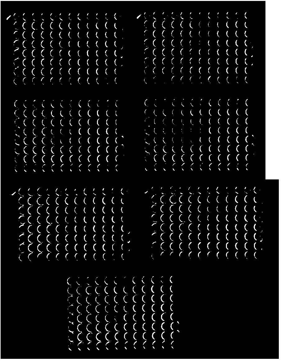 Avian metapneumovirus (aMPV) F protein polypeptide and application thereof