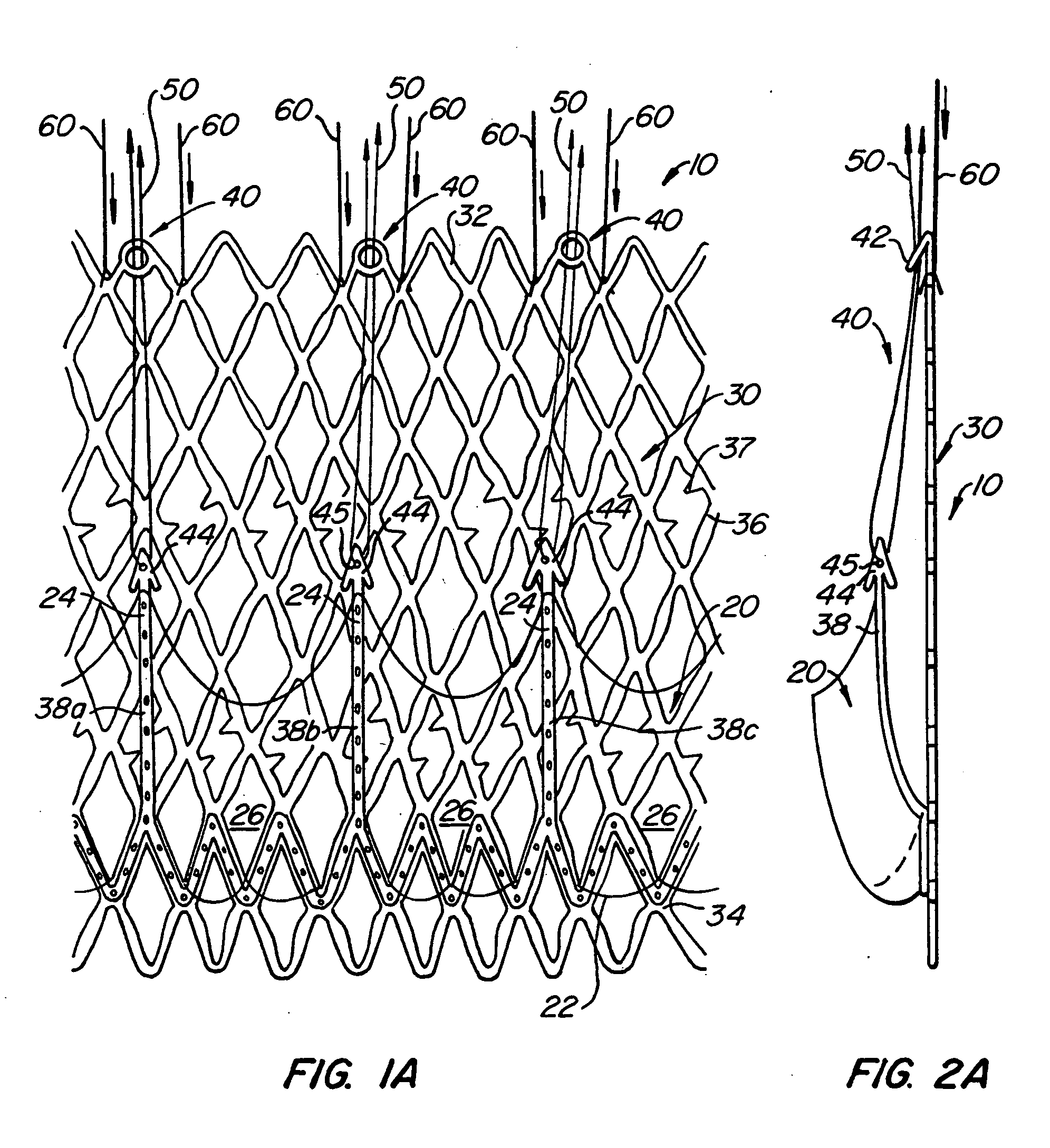 Heart valve anchor and method