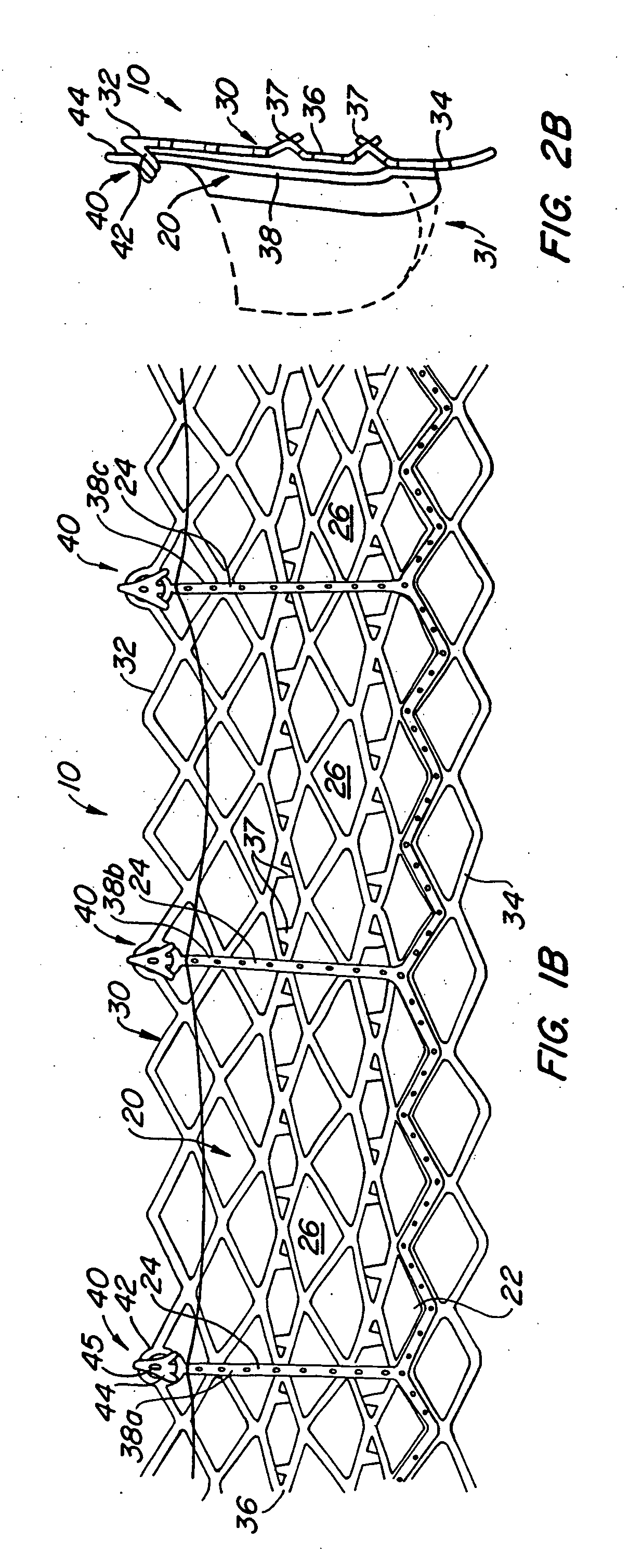 Heart valve anchor and method