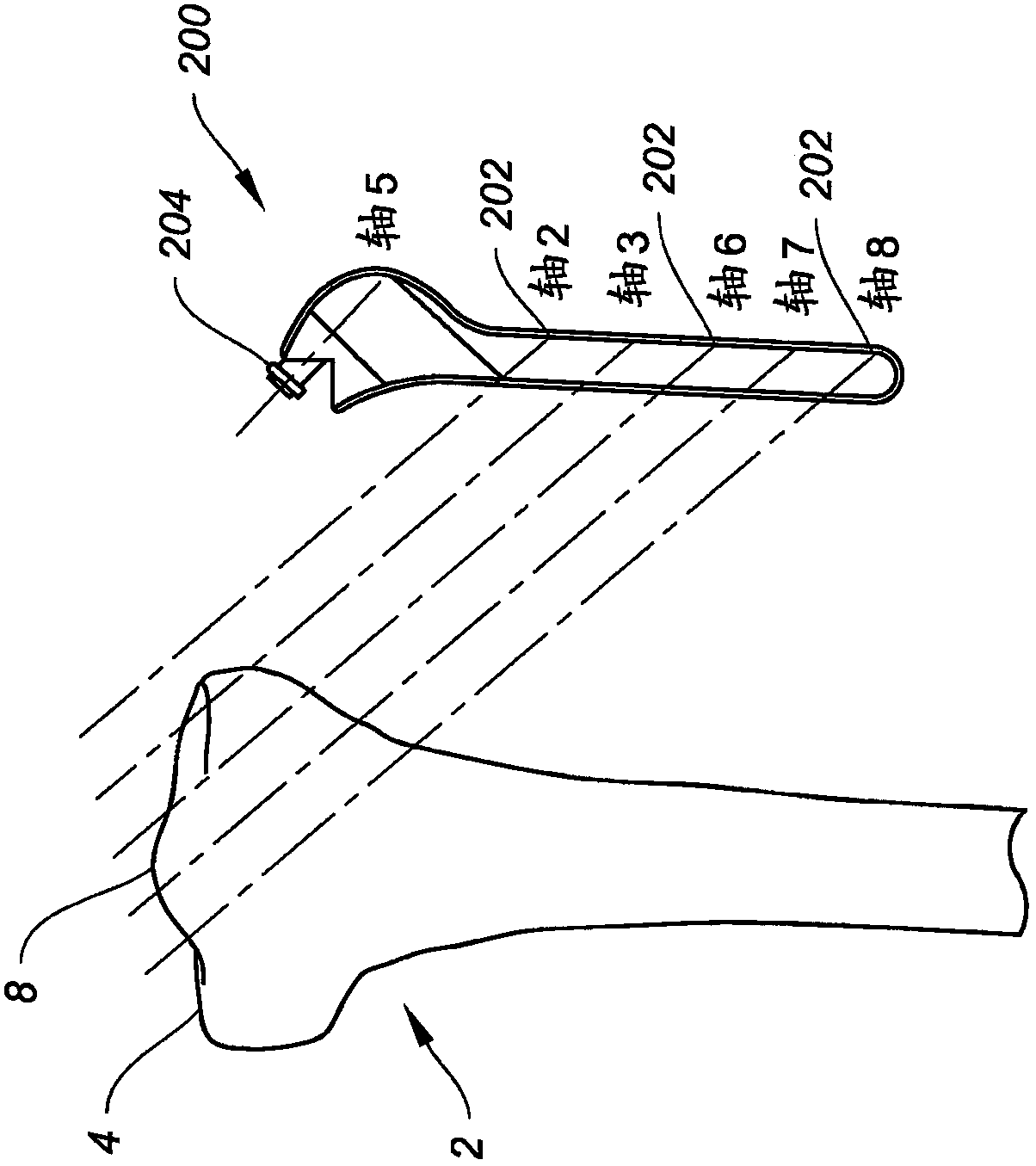 Navigation and positioning instruments for joint repair