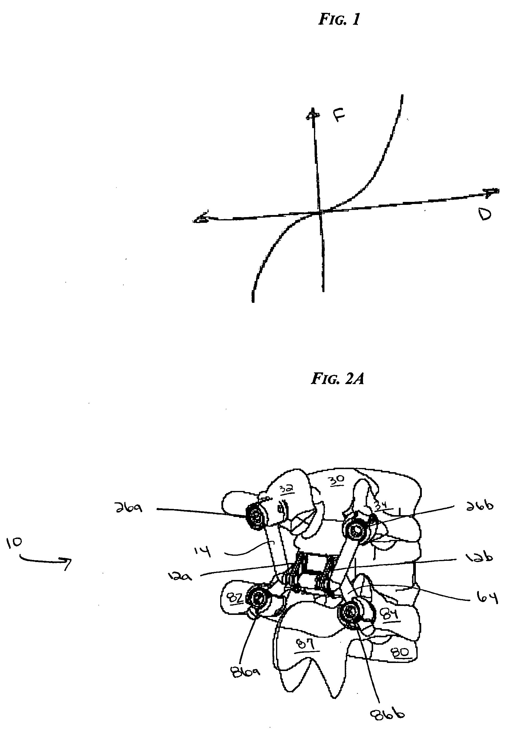 Non-linear artificial ligament system